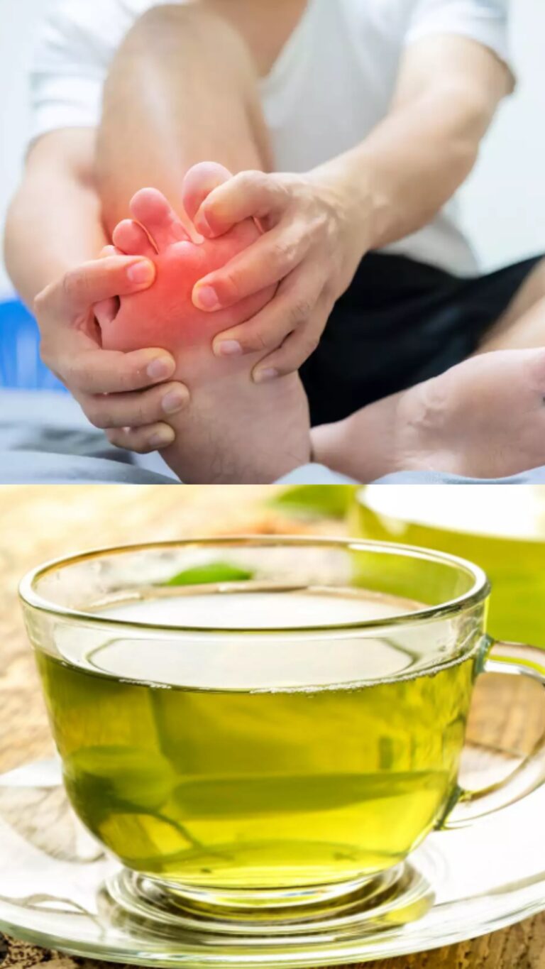 The Nectar of Relief: Navigating Gout Management Through the Lens of Our Daily Brews