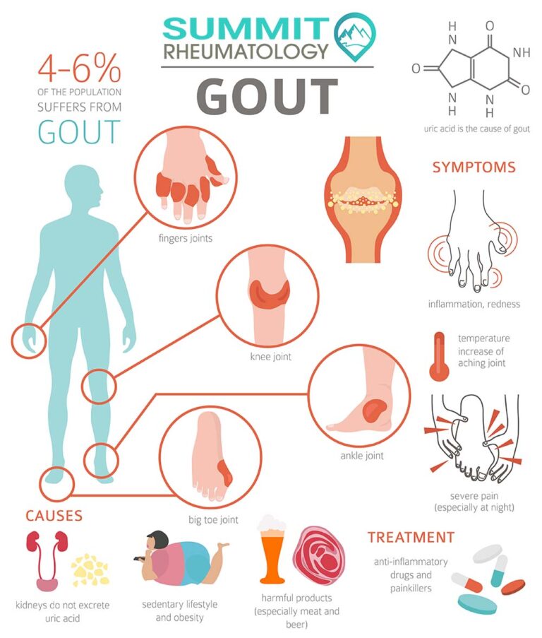 The Silent Saboteur: Gout in Women and the Unwritten Story of Misdiagnosis
