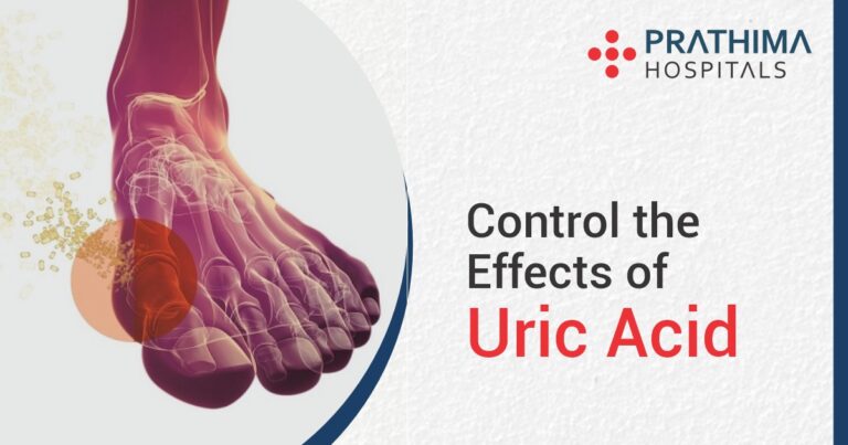 The Silent Threat: Why Getting Your Uric Acid Under Control is Crucial